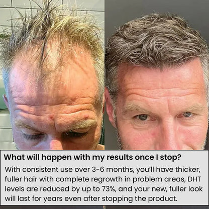 NeoRegrowth™ Hair Regrowth Serum